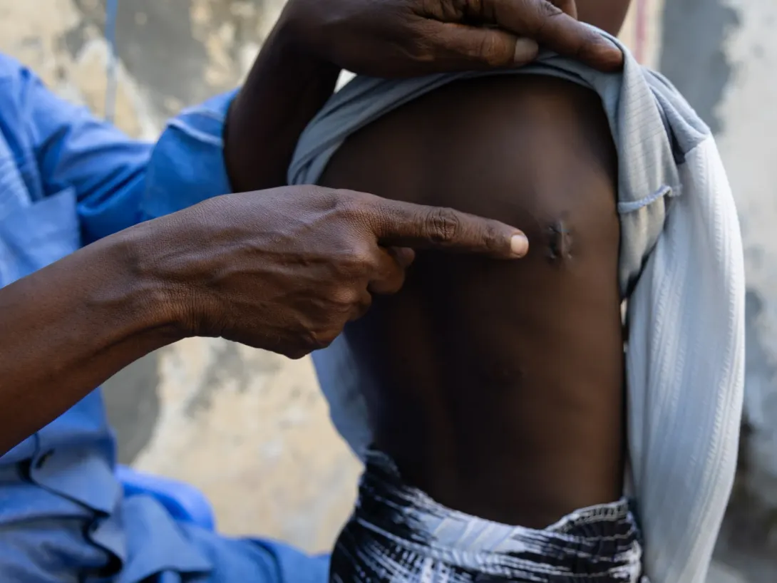 Editorial photograph illustrating Somalia strike surge exposes a widening US civilian-harm accountability gap